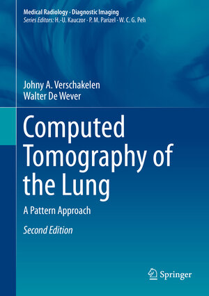 Buchcover Computed Tomography of the Lung | Johny A. Verschakelen | EAN 9783642395178 | ISBN 3-642-39517-1 | ISBN 978-3-642-39517-8