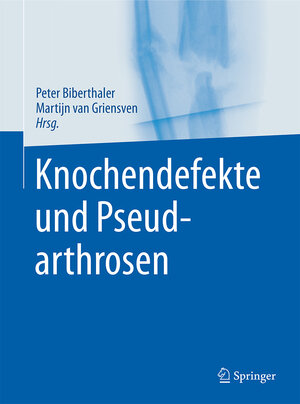 Buchcover Knochendefekte und Pseudarthrosen  | EAN 9783642449901 | ISBN 3-642-44990-5 | ISBN 978-3-642-44990-1