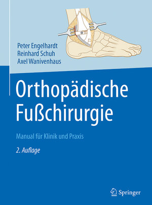 Buchcover Orthopädische Fußchirurgie | Peter Engelhardt | EAN 9783642449925 | ISBN 3-642-44992-1 | ISBN 978-3-642-44992-5
