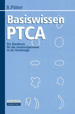 Buchcover Basiswissen PTCA | Brigitte Pütter | EAN 9783642477034 | ISBN 3-642-47703-8 | ISBN 978-3-642-47703-4