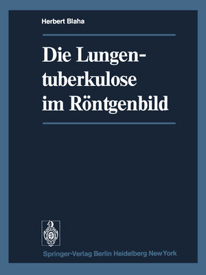 Buchcover Die Lungentuberkulose im Röntgenbild | H. Blaha | EAN 9783642491795 | ISBN 3-642-49179-0 | ISBN 978-3-642-49179-5