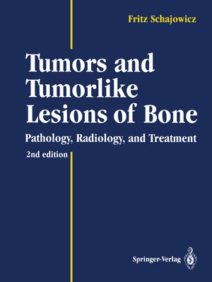 Buchcover Tumors and Tumorlike Lesions of Bone | Fritz Schajowicz | EAN 9783642499562 | ISBN 3-642-49956-2 | ISBN 978-3-642-49956-2