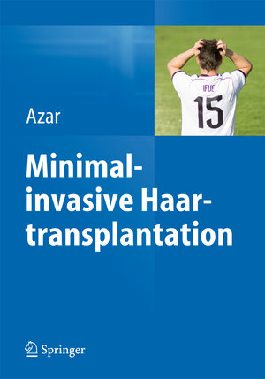 Buchcover Minimalinvasive Haartransplantation  | EAN 9783642545597 | ISBN 3-642-54559-9 | ISBN 978-3-642-54559-7