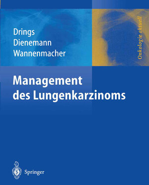 Buchcover Management des Lungenkarzinoms  | EAN 9783642556029 | ISBN 3-642-55602-7 | ISBN 978-3-642-55602-9