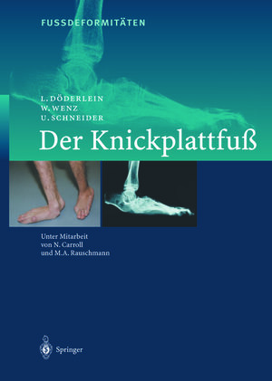 Buchcover FussdeformitÄten | L. Döderlein | EAN 9783642563904 | ISBN 3-642-56390-2 | ISBN 978-3-642-56390-4