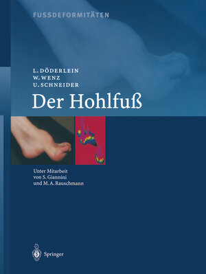 Buchcover Fussdeformitäten | L. Döderlein | EAN 9783642564529 | ISBN 3-642-56452-6 | ISBN 978-3-642-56452-9