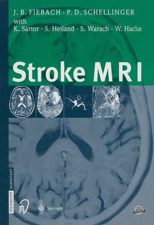 Buchcover Stroke MRI | Jochen Fiebach | EAN 9783642573873 | ISBN 3-642-57387-8 | ISBN 978-3-642-57387-3