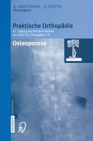Buchcover Osteoporose  | EAN 9783642574429 | ISBN 3-642-57442-4 | ISBN 978-3-642-57442-9