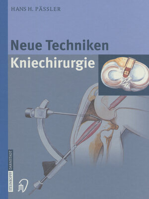 Buchcover Neue Techniken Kniechirurgie | H.H. Pässler | EAN 9783642575211 | ISBN 3-642-57521-8 | ISBN 978-3-642-57521-1