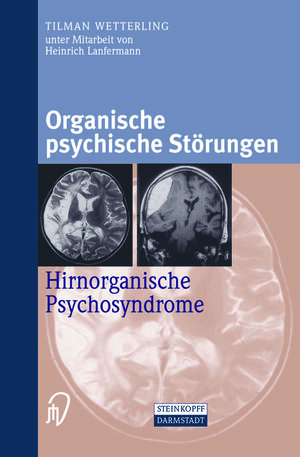 Buchcover Organische psychische Störungen | Tilman Wetterling | EAN 9783642575327 | ISBN 3-642-57532-3 | ISBN 978-3-642-57532-7