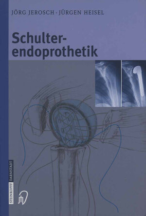 Buchcover Schulterendoprothetik | Jörg Jerosch | EAN 9783642575372 | ISBN 3-642-57537-4 | ISBN 978-3-642-57537-2