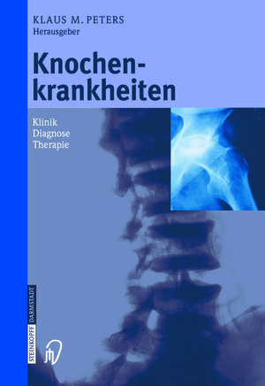 Buchcover Knochenkrankheiten  | EAN 9783642575419 | ISBN 3-642-57541-2 | ISBN 978-3-642-57541-9