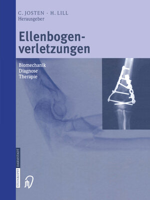 Buchcover Ellenbogenverletzungen  | EAN 9783642576195 | ISBN 3-642-57619-2 | ISBN 978-3-642-57619-5