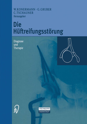 Buchcover Die Hüftreifungsstörung  | EAN 9783642586958 | ISBN 3-642-58695-3 | ISBN 978-3-642-58695-8