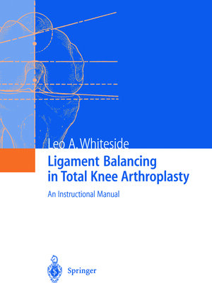 Buchcover Ligament Balancing in Total Knee Arthroplasty | Leo A. Whiteside | EAN 9783642592959 | ISBN 3-642-59295-3 | ISBN 978-3-642-59295-9