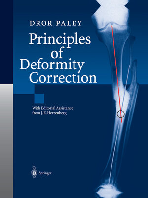 Buchcover Principles of Deformity Correction | Dror Paley | EAN 9783642593734 | ISBN 3-642-59373-9 | ISBN 978-3-642-59373-4