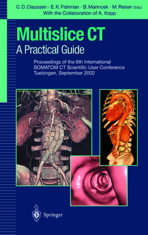 Buchcover Multislice CT: A Practical Guide | EAN 9783642594502 | ISBN 3-642-59450-6 | ISBN 978-3-642-59450-2