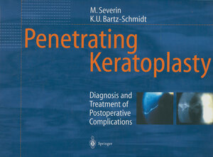 Buchcover Penetrating Keratoplasty | Maria Severin | EAN 9783642596841 | ISBN 3-642-59684-3 | ISBN 978-3-642-59684-1