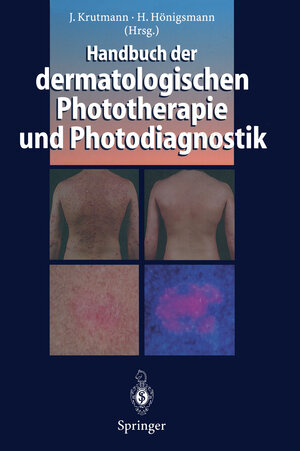 Buchcover Handbuch der dermatologischen Phototherapie und Photodiagnostik  | EAN 9783642604256 | ISBN 3-642-60425-0 | ISBN 978-3-642-60425-6