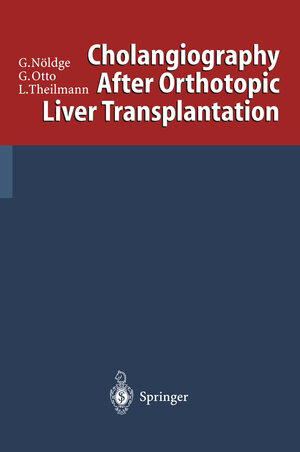 Buchcover Cholangiography After Orthotopic Liver Transplantation | Gerd Nöldge | EAN 9783642610646 | ISBN 3-642-61064-1 | ISBN 978-3-642-61064-6