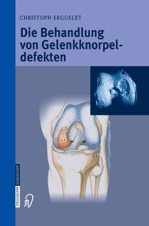 Buchcover Die Behandlung von Gelenkknorpeldefekten | Christoph Erggelet | EAN 9783642621697 | ISBN 3-642-62169-4 | ISBN 978-3-642-62169-7