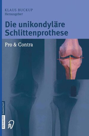Buchcover Die unikondyläre Schlittenprothese Pro & Contra  | EAN 9783642621710 | ISBN 3-642-62171-6 | ISBN 978-3-642-62171-0