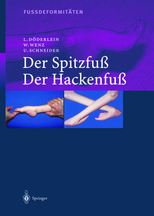 Buchcover Fussdeformitäten | Leonhard Döderlein | EAN 9783642622069 | ISBN 3-642-62206-2 | ISBN 978-3-642-62206-9