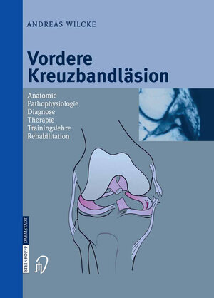 Buchcover Vordere Kreuzbandläsion | Andreas Wilcke | EAN 9783642623790 | ISBN 3-642-62379-4 | ISBN 978-3-642-62379-0