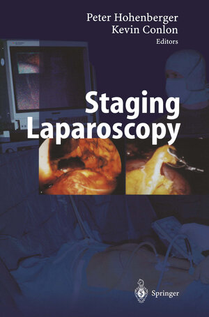 Buchcover Staging Laparoscopy  | EAN 9783642630002 | ISBN 3-642-63000-6 | ISBN 978-3-642-63000-2
