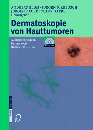 Buchcover Dermatoskopie von Hauttumoren  | EAN 9783642632686 | ISBN 3-642-63268-8 | ISBN 978-3-642-63268-6