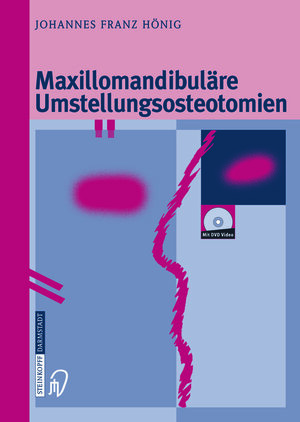 Buchcover Maxillomandibuläre Umstellungsosteotomien | Johannes-Franz Hönig | EAN 9783642632846 | ISBN 3-642-63284-X | ISBN 978-3-642-63284-6