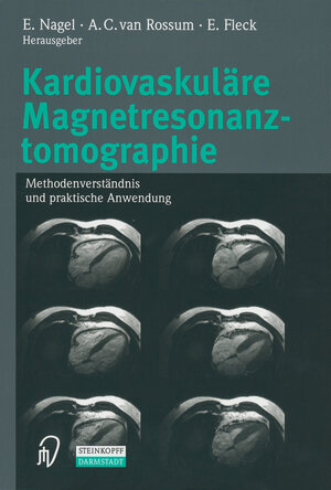 Buchcover Kardiovaskuläre Magnetresonanztomographie  | EAN 9783642632914 | ISBN 3-642-63291-2 | ISBN 978-3-642-63291-4