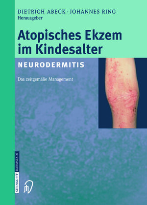 Buchcover Atopisches Ekzem im Kindesalter (Neurodermitis)  | EAN 9783642632945 | ISBN 3-642-63294-7 | ISBN 978-3-642-63294-5