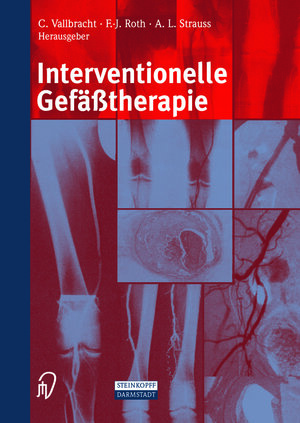 Buchcover Interventionelle Gefäßtherapie  | EAN 9783642632969 | ISBN 3-642-63296-3 | ISBN 978-3-642-63296-9