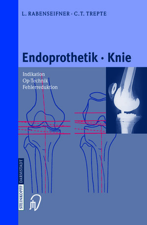 Buchcover Endoprothetik Knie | L. Rabenseifner | EAN 9783642633133 | ISBN 3-642-63313-7 | ISBN 978-3-642-63313-3