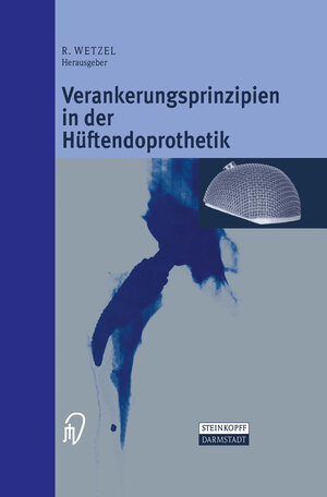 Buchcover Verankerungsprinzipien in der Hüftendoprothetik  | EAN 9783642633195 | ISBN 3-642-63319-6 | ISBN 978-3-642-63319-5