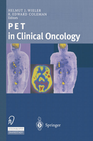Buchcover PET in Clinical Oncology  | EAN 9783642633294 | ISBN 3-642-63329-3 | ISBN 978-3-642-63329-4