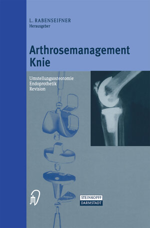 Buchcover Arthrosemanagement Knie  | EAN 9783642633355 | ISBN 3-642-63335-8 | ISBN 978-3-642-63335-5