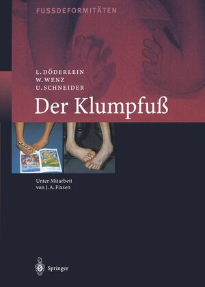 Buchcover Der Klumpfuss | Leonhard Döderlein | EAN 9783642635779 | ISBN 3-642-63577-6 | ISBN 978-3-642-63577-9