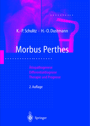 Buchcover Morbus Perthes | Klaus-Peter Schulitz | EAN 9783642637728 | ISBN 3-642-63772-8 | ISBN 978-3-642-63772-8