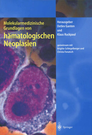 Buchcover Molekularmedizinische Grundlagen von hämatologischen Neoplasien  | EAN 9783642639418 | ISBN 3-642-63941-0 | ISBN 978-3-642-63941-8
