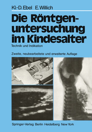 Buchcover Die Röntgenuntersuchung im Kindesalter | Klaus-D. Ebel | EAN 9783642670329 | ISBN 3-642-67032-6 | ISBN 978-3-642-67032-9