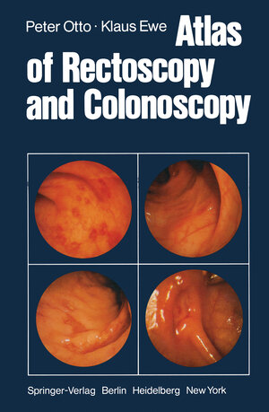 Buchcover Atlas of Rectoscopy and Coloscopy | P. Otto | EAN 9783642672507 | ISBN 3-642-67250-7 | ISBN 978-3-642-67250-7