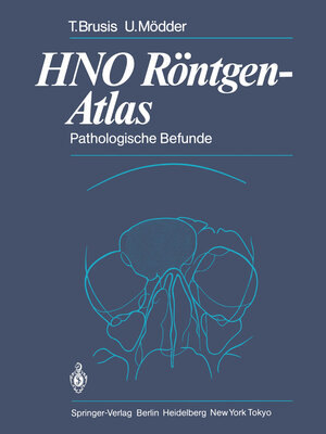Buchcover HNO Röntgen-Atlas | Tilman Brusis | EAN 9783642692413 | ISBN 3-642-69241-9 | ISBN 978-3-642-69241-3