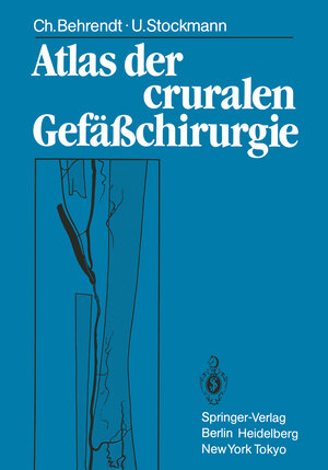 Buchcover Atlas der cruralen Gefäßchirurgie | Christina Behrendt | EAN 9783642700514 | ISBN 3-642-70051-9 | ISBN 978-3-642-70051-4