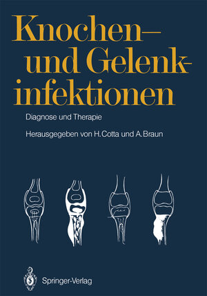 Buchcover Knochen- und Gelenkinfektionen  | EAN 9783642717734 | ISBN 3-642-71773-X | ISBN 978-3-642-71773-4