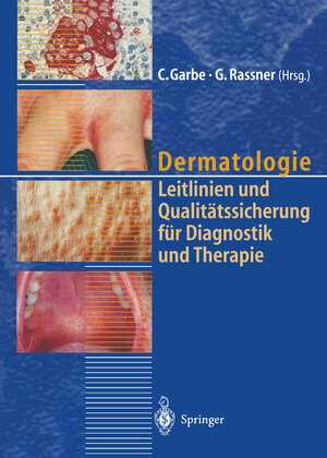 Buchcover Dermatologie  | EAN 9783642719745 | ISBN 3-642-71974-0 | ISBN 978-3-642-71974-5