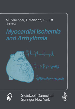 Buchcover Myocardial Ischemia and Arrhythmia  | EAN 9783642725074 | ISBN 3-642-72507-4 | ISBN 978-3-642-72507-4