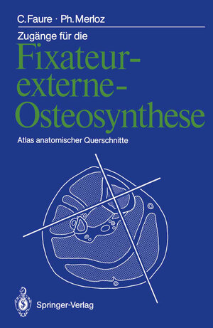 Buchcover Zugänge für die Fixateur-externe-Osteosynthese | Claude Faure | EAN 9783642726262 | ISBN 3-642-72626-7 | ISBN 978-3-642-72626-2