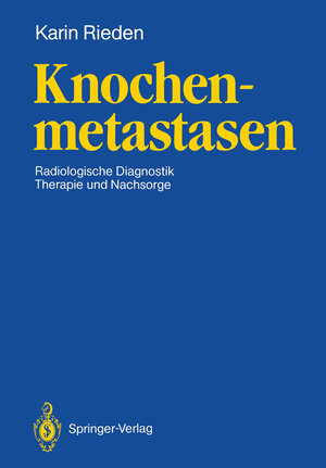 Buchcover Knochenmetastasen | Karin Rieden | EAN 9783642735196 | ISBN 3-642-73519-3 | ISBN 978-3-642-73519-6